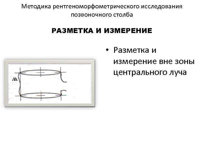 Методика рентгеноморфометрического исследования позвоночного столба РАЗМЕТКА И ИЗМЕРЕНИЕ А А • Разметка и измерение