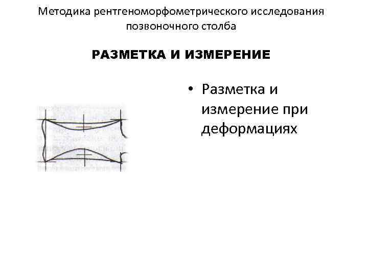 Методика рентгеноморфометрического исследования позвоночного столба РАЗМЕТКА И ИЗМЕРЕНИЕ • Разметка и измерение при деформациях