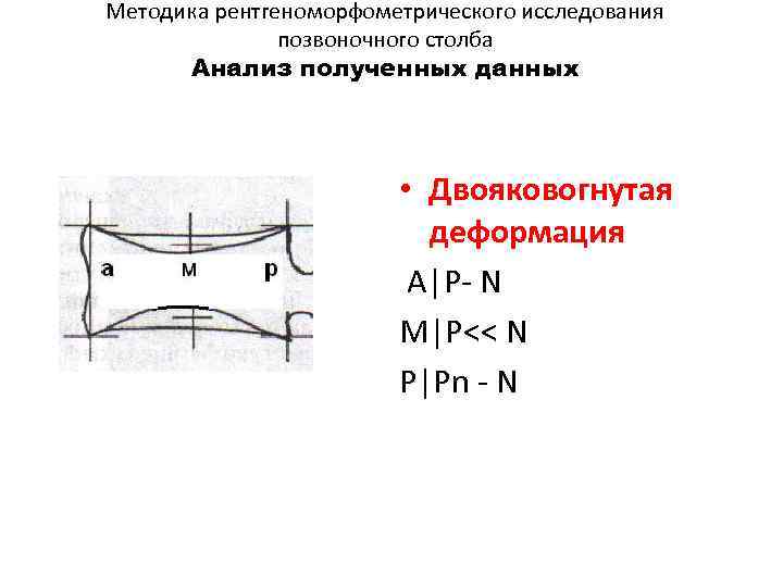 Методика рентгеноморфометрического исследования позвоночного столба Анализ полученных данных • Двояковогнутая деформация A|P- N M|P<<