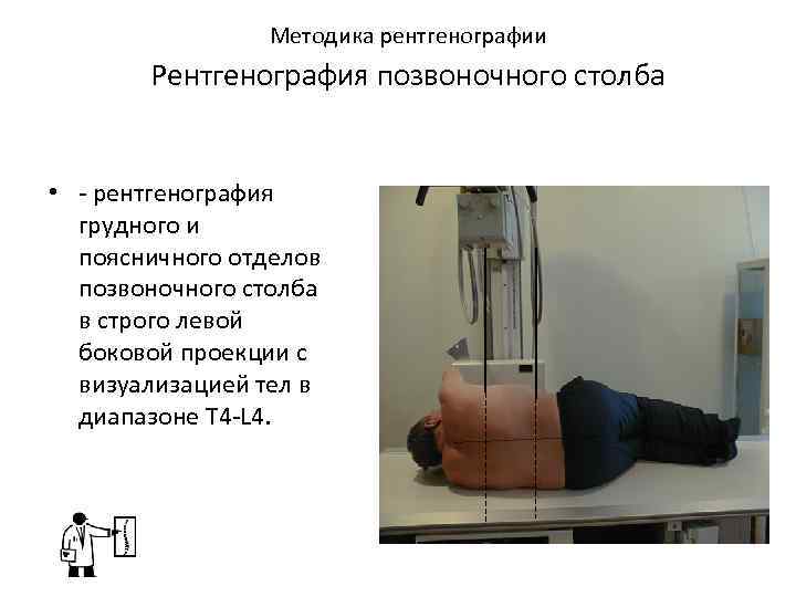 Методика рентгенографии Рентгенография позвоночного столба • - рентгенография грудного и поясничного отделов позвоночного столба