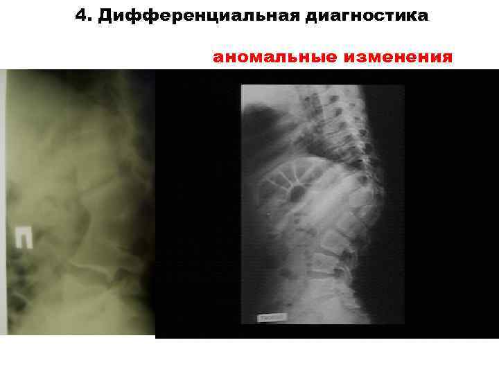 4. Дифференциальная диагностика аномальные изменения 