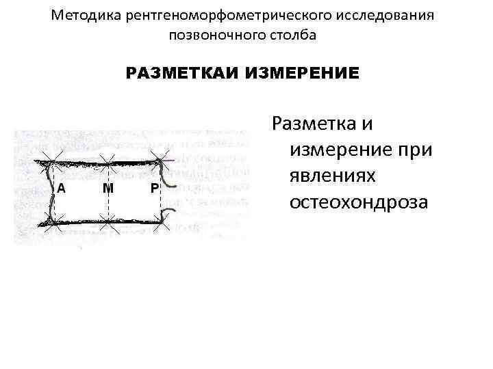 Методика рентгеноморфометрического исследования позвоночного столба РАЗМЕТКАИ ИЗМЕРЕНИЕ М Р Разметка и измерение при явлениях