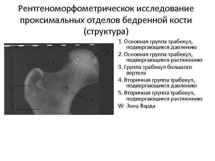 Область большого вертела бедренной кости фото