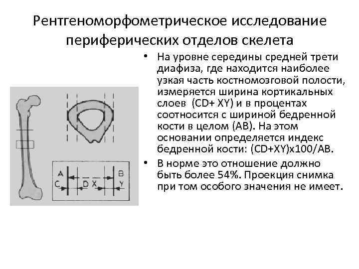 Рентгеноморфометрическое исследование периферических отделов скелета • На уровне середины средней трети диафиза, где находится