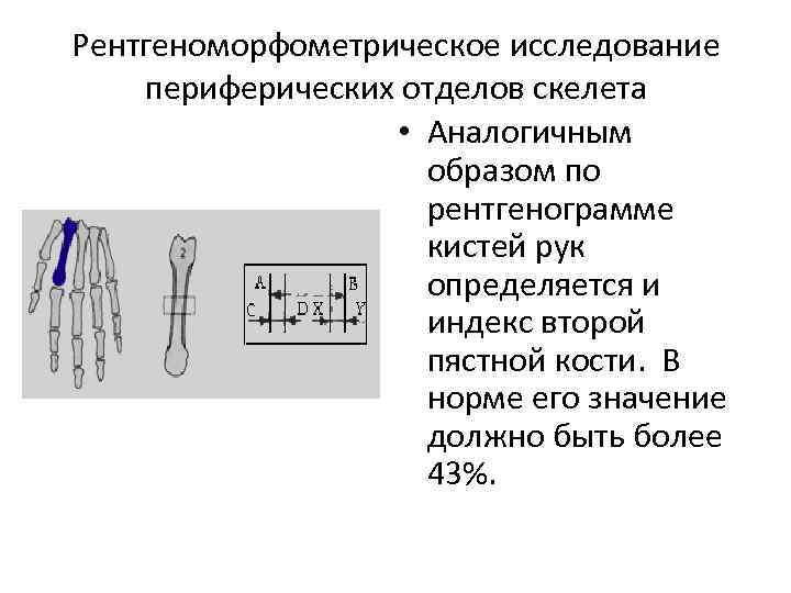 Рентгеноморфометрическое исследование периферических отделов скелета • Аналогичным образом по рентгенограмме кистей рук определяется и