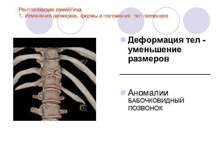 Лучевая анатомия семиотика