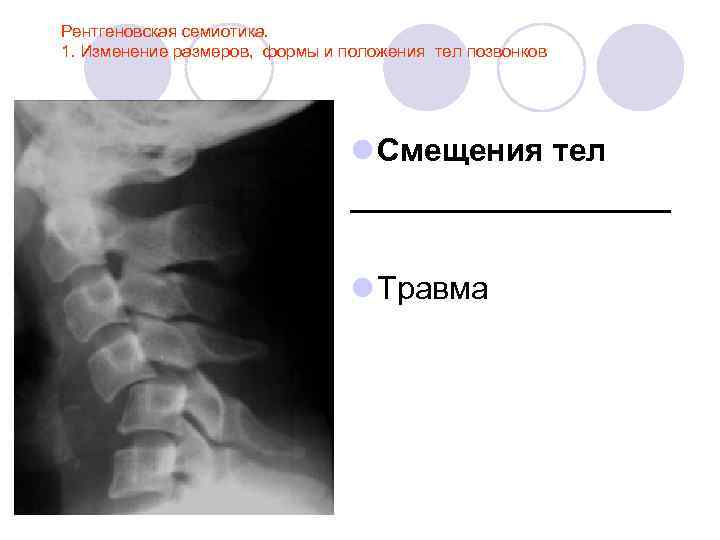 Лучевая анатомия семиотика