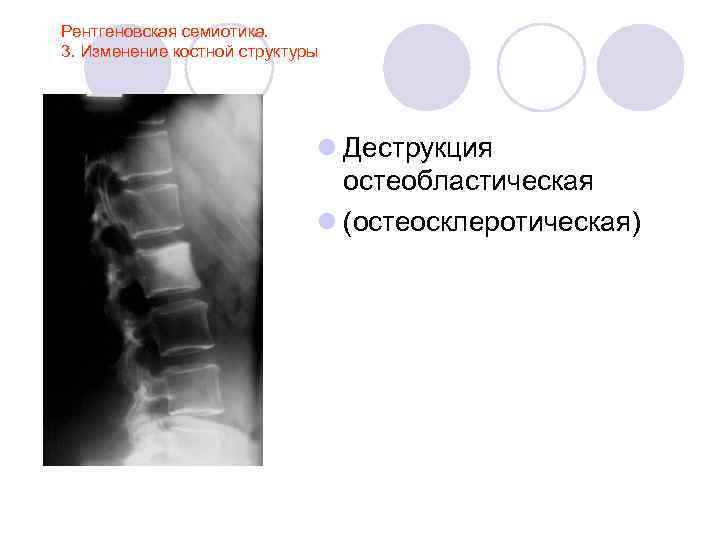 Лучевая анатомия семиотика