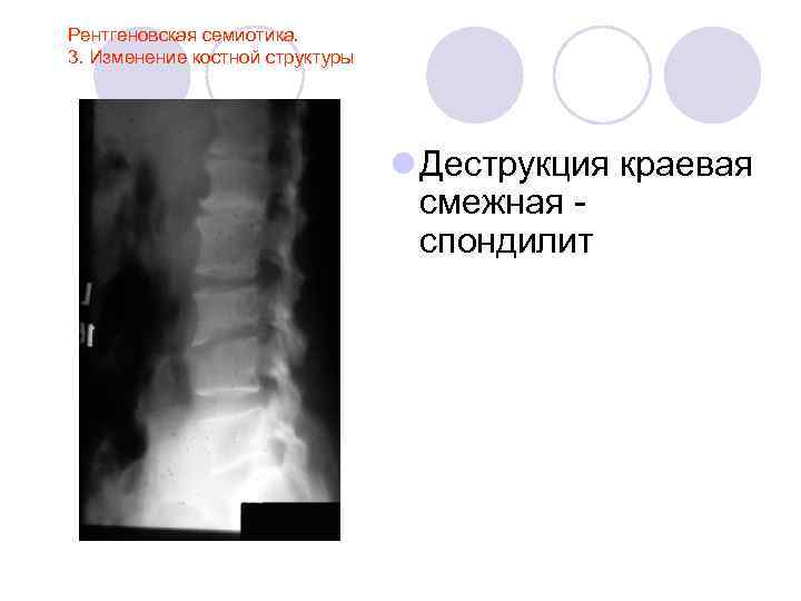 Лучевая анатомия семиотика