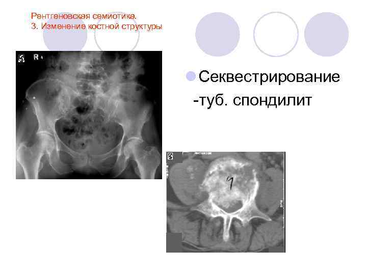 Лучевая анатомия семиотика