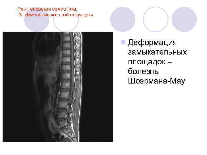 Лучевая анатомия семиотика