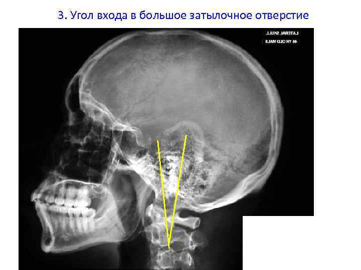 Чтобы размеры рентгеновского изображения были близки к истинным следует максимально