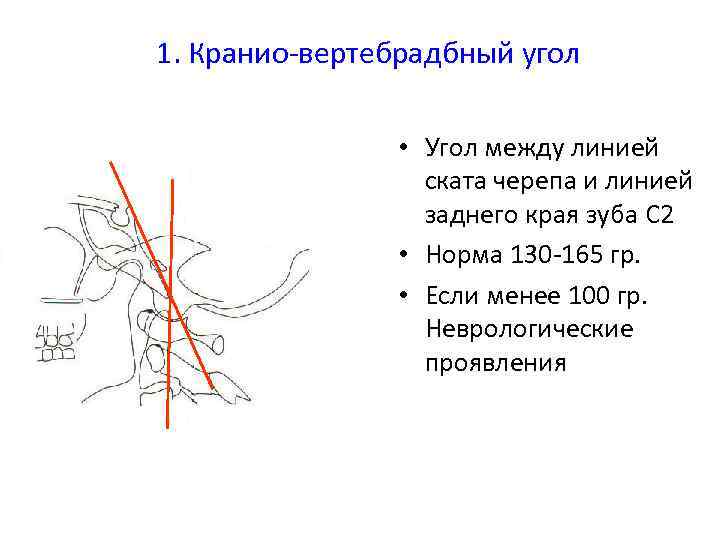 Угол наклона зуба шестерни