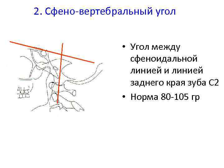 Угол наклона зуба шестерни