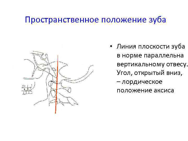 Пространственное положение зуба • Линия плоскости зуба в норме параллельна вертикальному отвесу. Угол, открытый