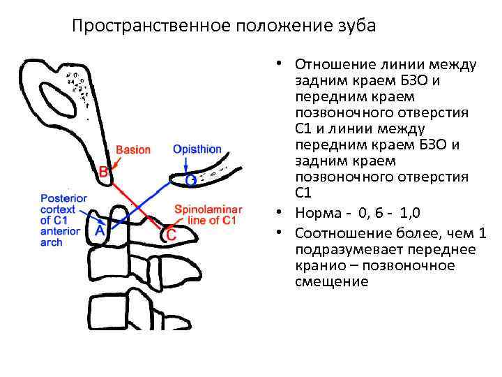 Схема описания ортопантомограммы