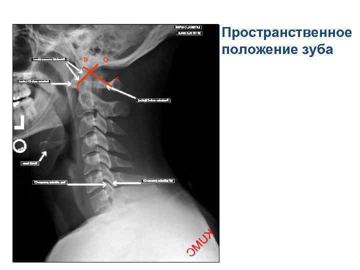 Разрешение рентгеновского изображения