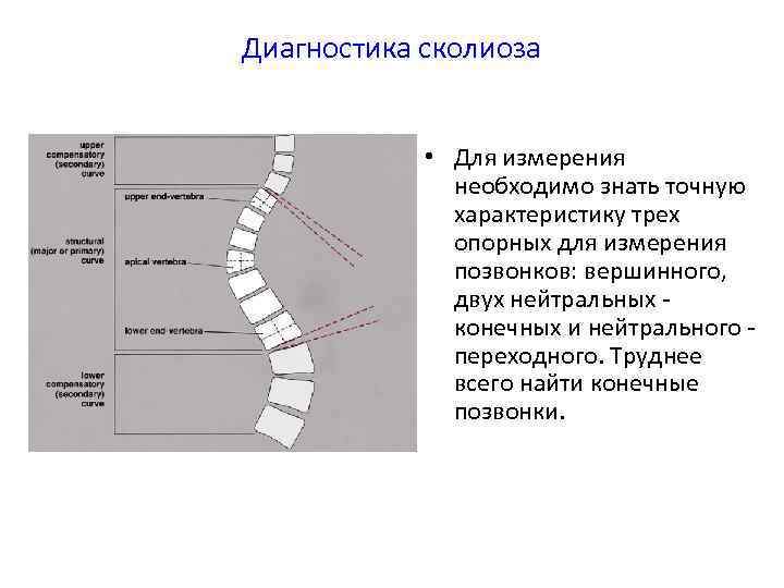 Диагностика сколиоза • Для измерения необходимо знать точную характеристику трех опорных для измерения позвонков: