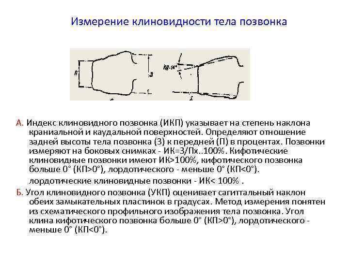 Клиновидные позвонки. Степени компрессии тел позвонков. Клиновидная деформация тел позвонков. Клиновидная деформация позвонков степени. Клиновидная деформация позвонков 1 степени.