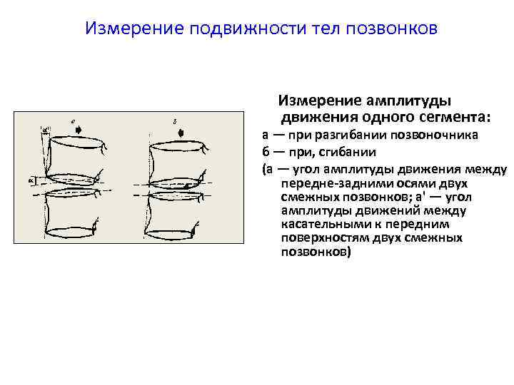  Измерение подвижности тел позвонков Измерение амплитуды движения одного сегмента: а — при разгибании