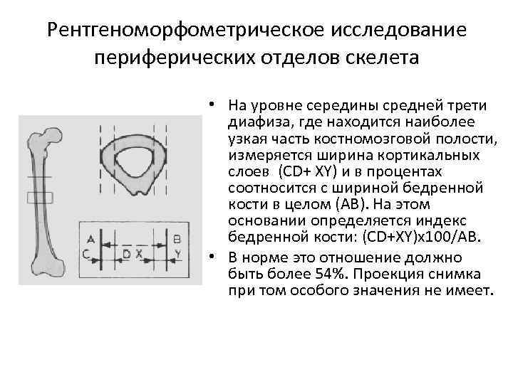 Рентгеноморфометрическое исследование периферических отделов скелета • На уровне середины средней трети диафиза, где находится