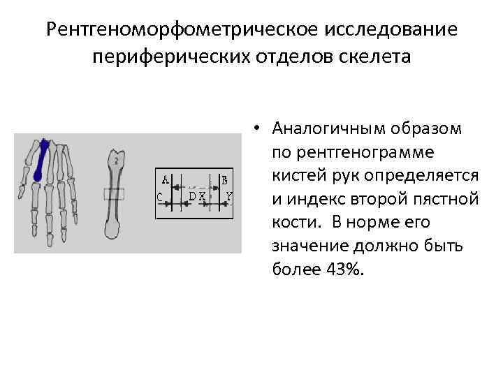 Рентгеноморфометрическое исследование периферических отделов скелета • Аналогичным образом по рентгенограмме кистей рук определяется и