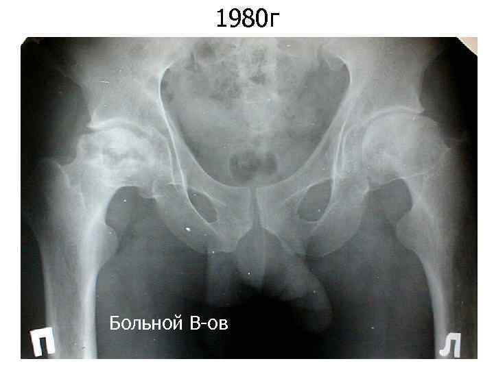 1980 г Больной В-ов 