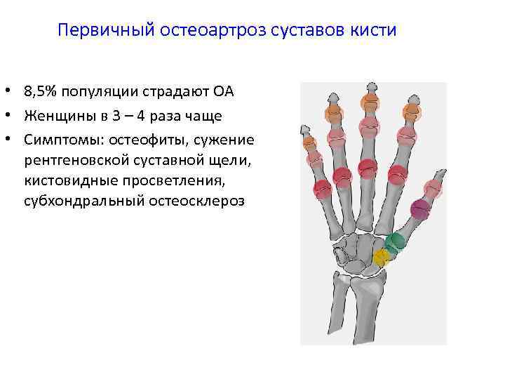 Остеоартроз кистей. Кистовидные просветления в костях кистей. Остеоартроз суставов кистей. Остеоартроз суставов кистей диагноз. Остеоартроз лучевая диагностика.