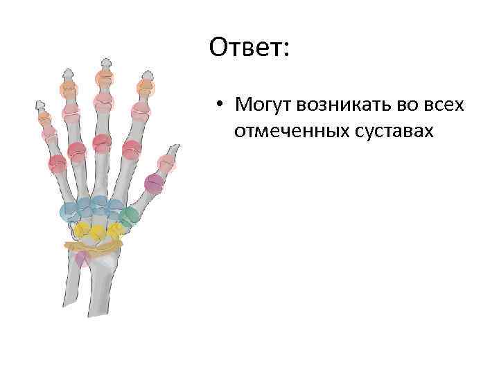 Ответ: • Могут возникать во всех отмеченных суставах 