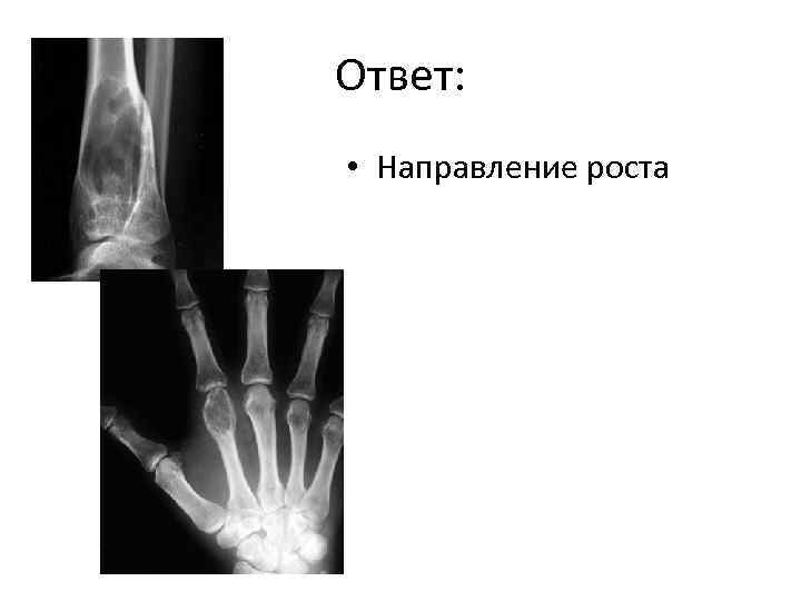 Ответ: • Направление роста 