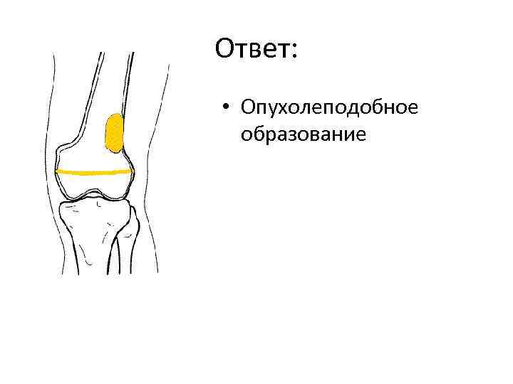 Ответ: • Опухолеподобное образование 