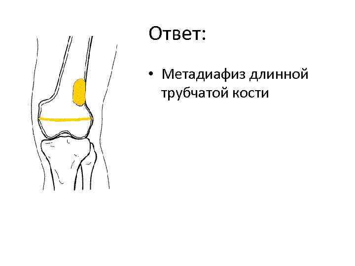 Ответ: • Метадиафиз длинной трубчатой кости 
