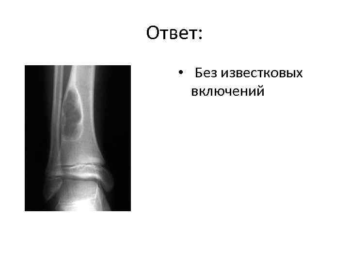 Ответ: • Без известковых включений 