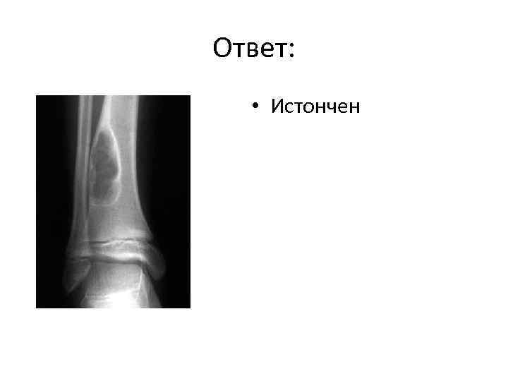 Ответ: • Истончен 