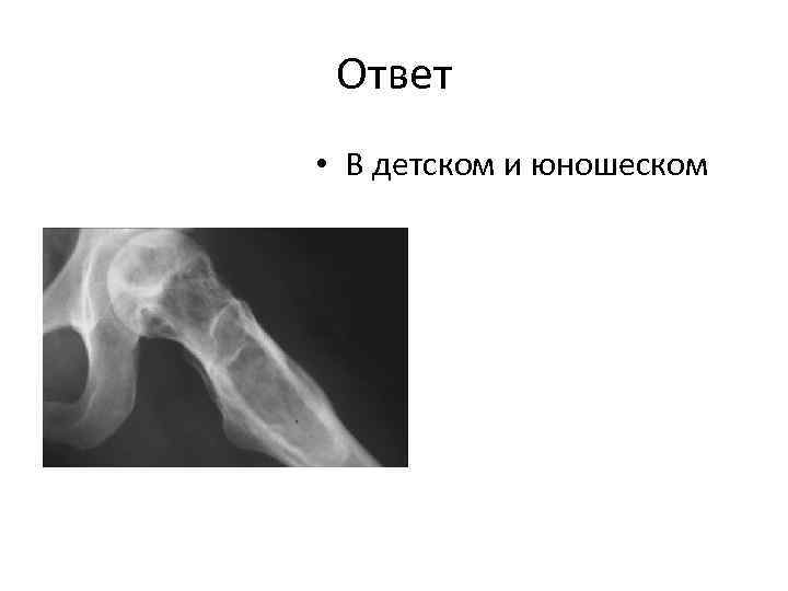Ответ • В детском и юношеском 