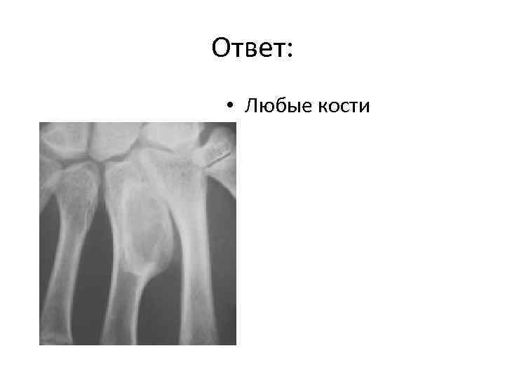 Ответ: • Любые кости 