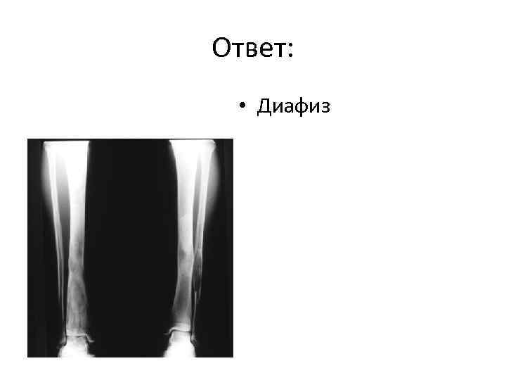 Ответ: • Диафиз 