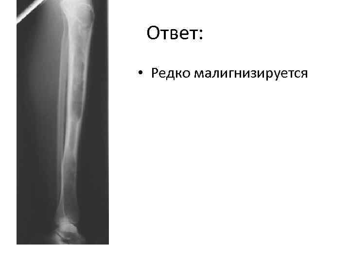 Ответ: • Редко малигнизируется 