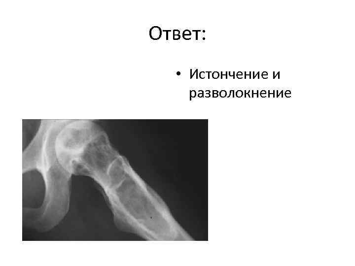 Ответ: • Истончение и разволокнение 