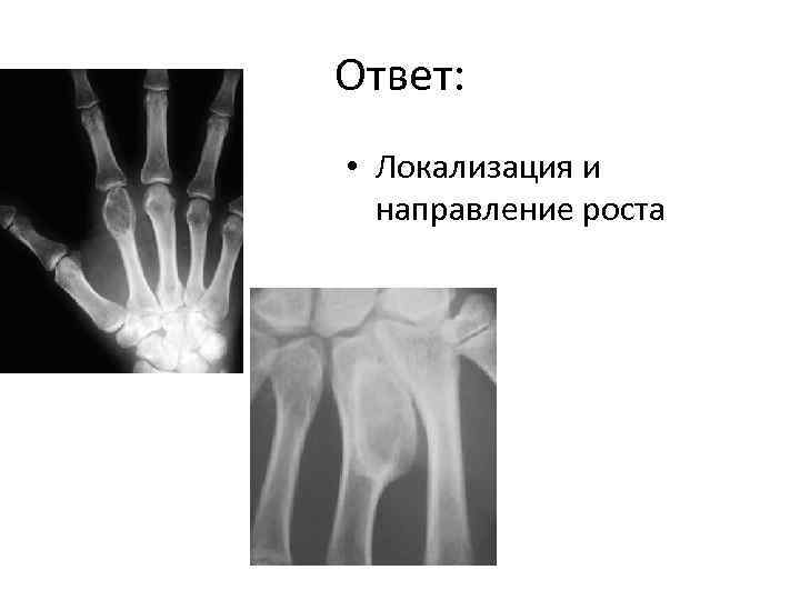 Ответ: • Локализация и направление роста 