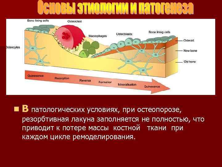 n В патологических условиях, при остеопорозе, резорбтивная лакуна заполняется не полностью, что приводит к