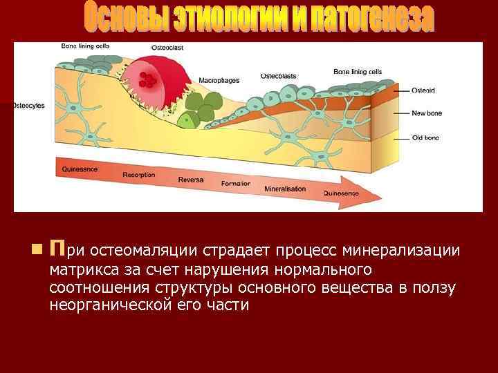 n При остеомаляции страдает процесс минерализации матрикса за счет нарушения нормального соотношения структуры основного