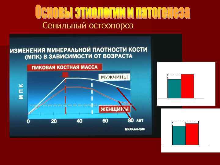 Сенильный остеопороз 