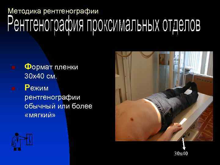 Методика рентгенографии n Формат пленки 30 х40 см. n Режим рентгенографии обычный или более