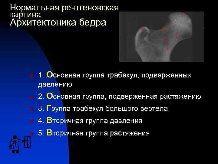 Нормальная рентгеновская картина Архитектоника бедра 1 3 2 w 5 4 n 1. Основная