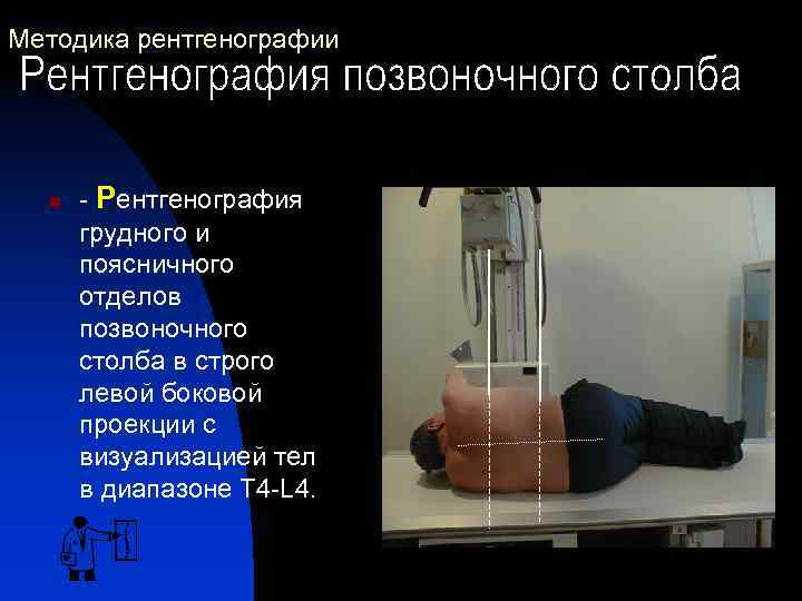 Методика рентгенографии n - Рентгенография грудного и поясничного отделов позвоночного столба в строго левой