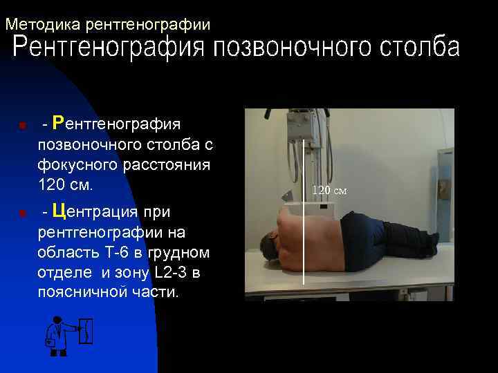 Методика рентгенографии n n - Рентгенография позвоночного столба с фокусного расстояния 120 см. -