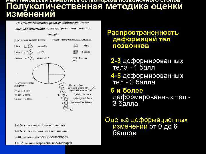 Рентгеновская семиотика остеопороза позвоночного столба Полуколичественная методика оценки изменений Распространенность деформаций тел позвонков 2