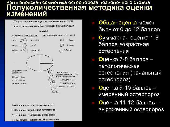 Рентгеновская семиотика остеопороза позвоночного столба Полуколичественная методика оценки изменений n n n Общая оценка