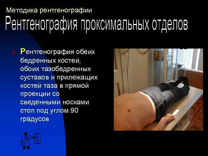 Методика рентгенографии n Рентгенография обеих бедренных костей, обоих тазобедренных суставов и прилежащих костей таза